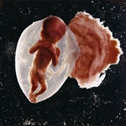 Fetus, 18 Weeks - Lennart Nilsson
