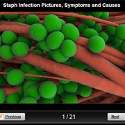 Staph Infection