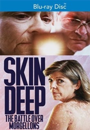 Skin Deep: The Battle Over Morgellons (2019)