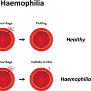 Hemophilia Awareness Month (March)