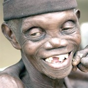 Calling a Teacher a Leper