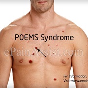 POEMS Syndrome
