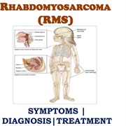 Rhabdomyosarcoma