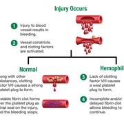 Hemophilia