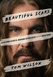 Beautiful Scars (Tom Wilson)