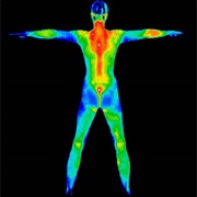 Thermography