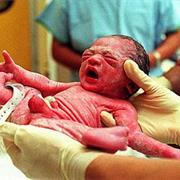Childbirth