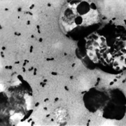 Pneumonic Plague