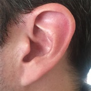 Attached Earlobes