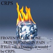 Reflex Sympathetic Dystrophy (RSD)/Complex Regional Pain Syndrome (CRPS)