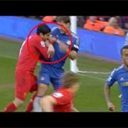 Luis Suarez Bites Again