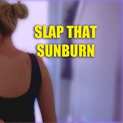 Slapping Sunburn
