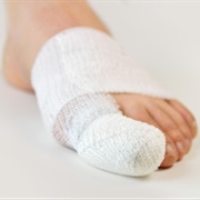 Broken Toe