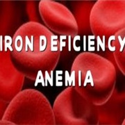 Iron Deficiency Anemia