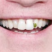 Food Stuck in Your Teeth