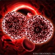 Blood Cancer