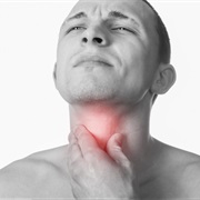 Laryngitis