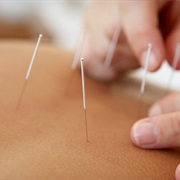 Get Acupuncture