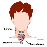 Paradoxical Vocal Cord Disfunction