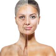 Thread Lift Facelift