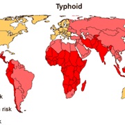 Typhoid Fever