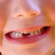 Loose a Tooth
