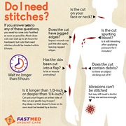 Need Stitches