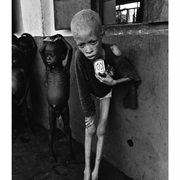 Albino Boy, Biafra - Don McCullin