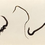 Schistosomiasis (Bilharzia)