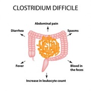 Clostridium Difficile