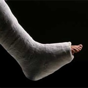 Broke a Leg