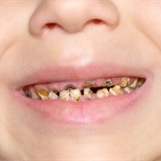 You Skip Going to Doctors, or Dentists.