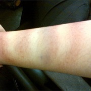 You've Been Abused in Any Form.