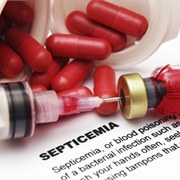 Blood Poisoning (Sepsis)