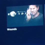 Wounds