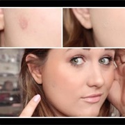 Accidentally Burn My Face