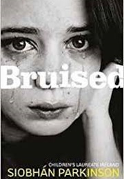 Bruised (Siobhan Parkinson)