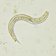 Threadworms