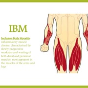 Inclusion Body Myositis (IBM)
