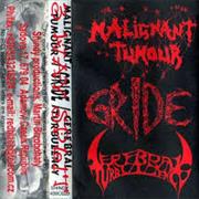 Malignant Tumour / Cerebral Turbulency / Gride