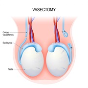 World Vasectomy Day (October 18)
