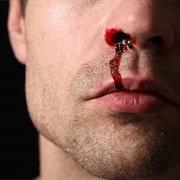 A Bloody Nose
