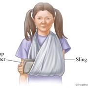 Make a Splint or Sling