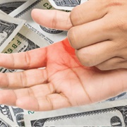An Itchy Palm Means Financial Windfall