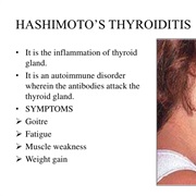 Hashimoto's Thyroiditis