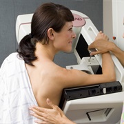 Mammogram