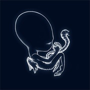 Starálfur - Sigur Rós