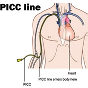 PICC Line