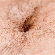 Had Belly Button Lint