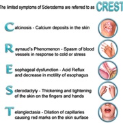 CREST Syndrome